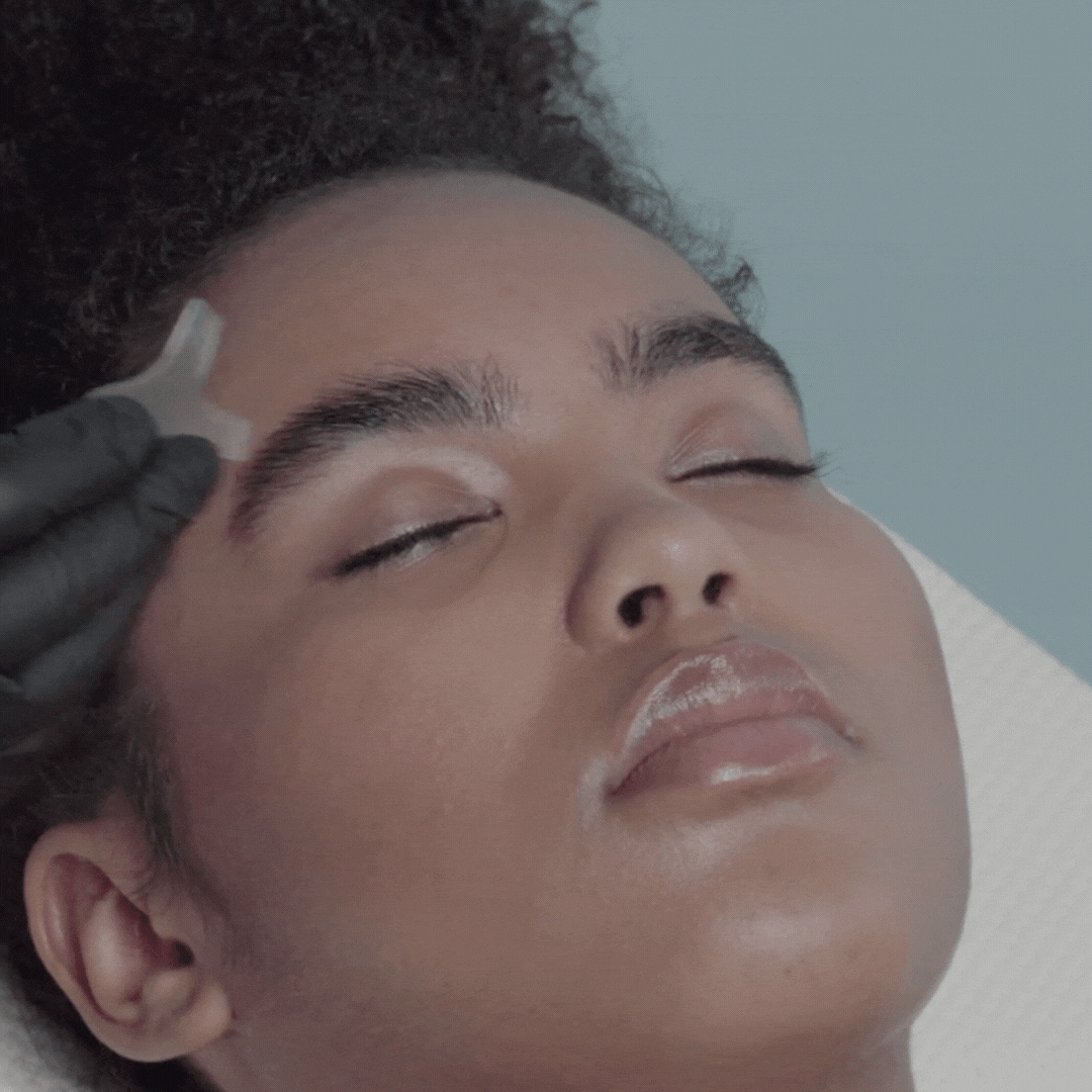 Browlift How-To