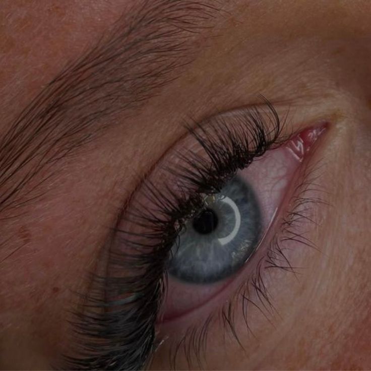 Augenkrankheiten & Wimpernbehandlungen: Wissenswertes